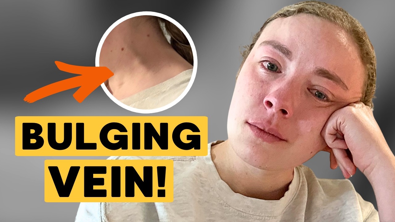 My Stage 4 Cancer Was Caught By ACCIDENT In The Emergency Room! &ldquo;I thought, am I going to die?&rdquo;