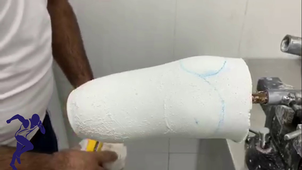 Transtibial prosthesis casting