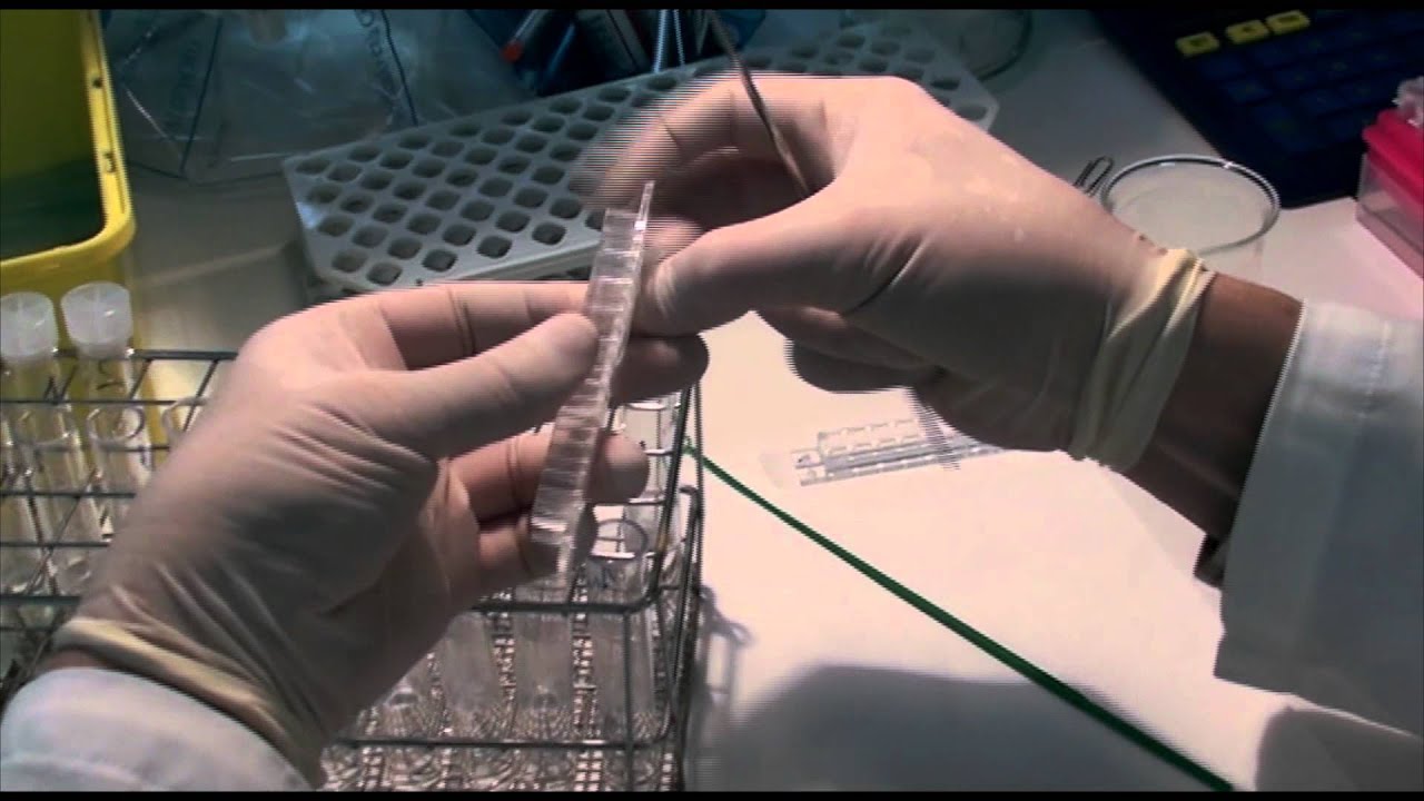 Pulsed Field Gel Electrophoresis (PFGE)