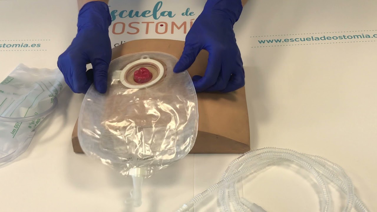 Bolsa de urostomía