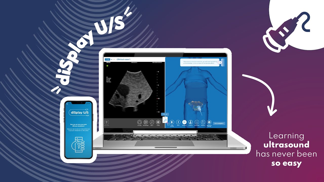 diSplay U/S - Online ultrasound simulator