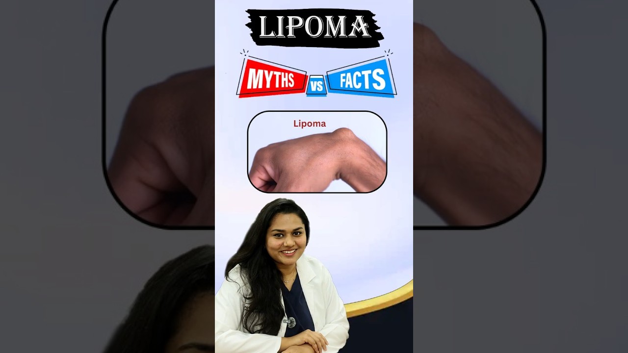 Lipoma: Myths vs Facts | Can Lipoma Turn Into Cancer? #drvasumathi #lipoma