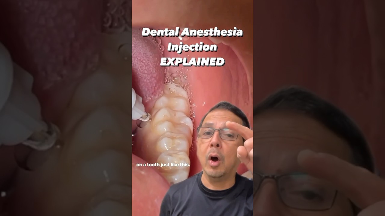 Dental Anesthesia: Everything You NEED to KNOW | View Mobile Dental