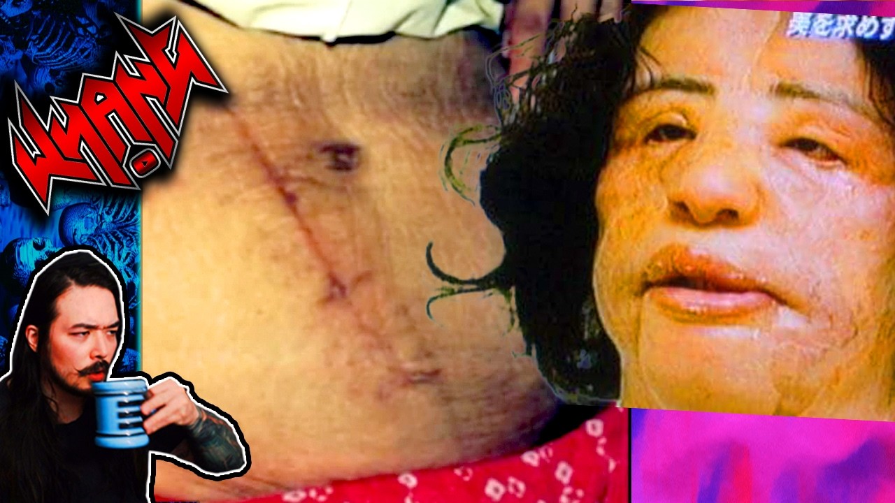Performed Medical Procedures on Themselves - Tales From the Internet