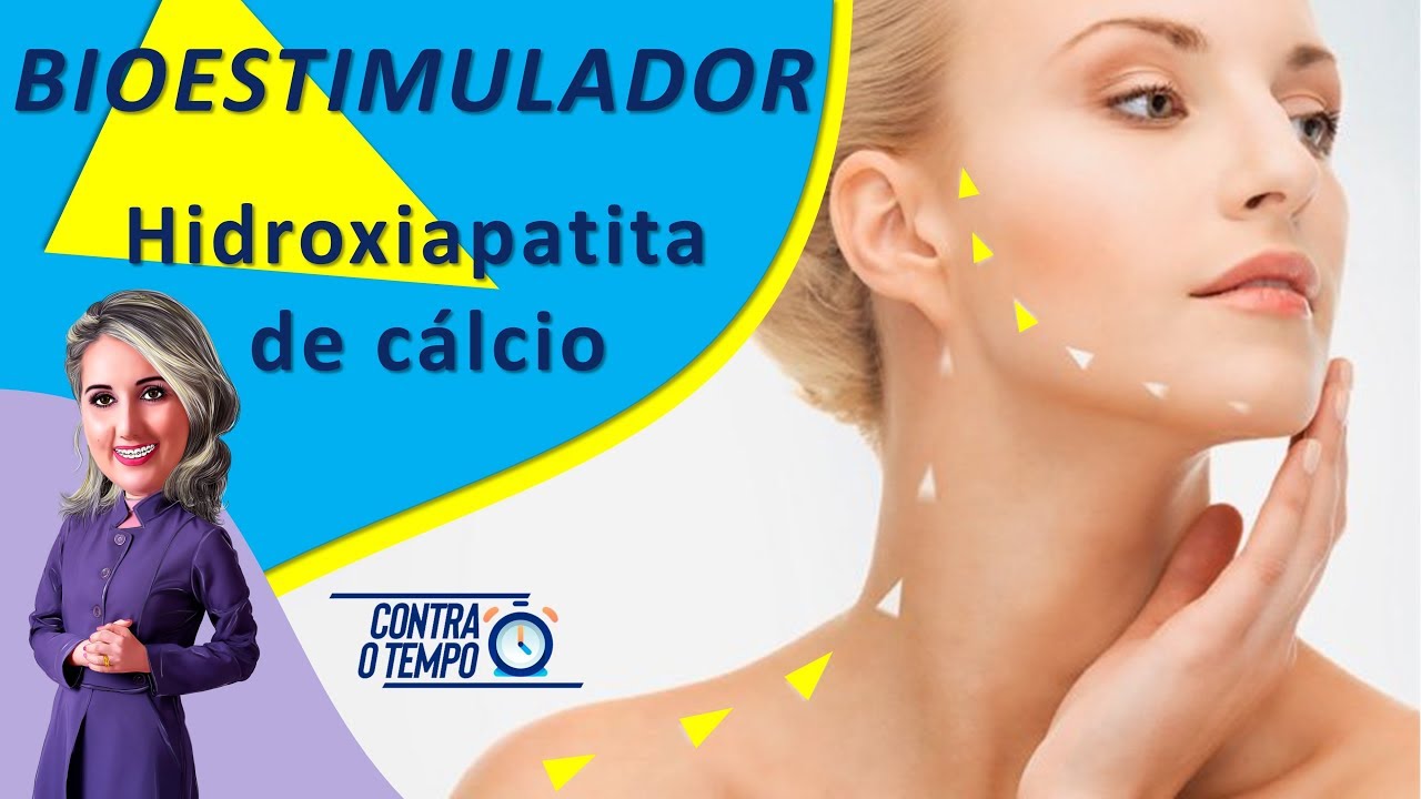 Hidroxiapatita de Calcio: RADIESSE. ESTIMULADOR de Colágeno para redução da flacidez.