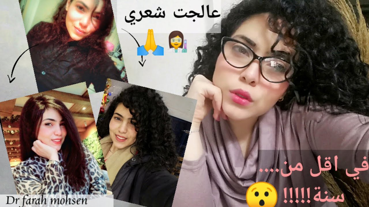 وصلت شعري من مقصف متقطع مبيطولش لشعر صحي لامع بيطول ٣ سم شهريا.. في اقل من سنة.. بالصورررر!!!