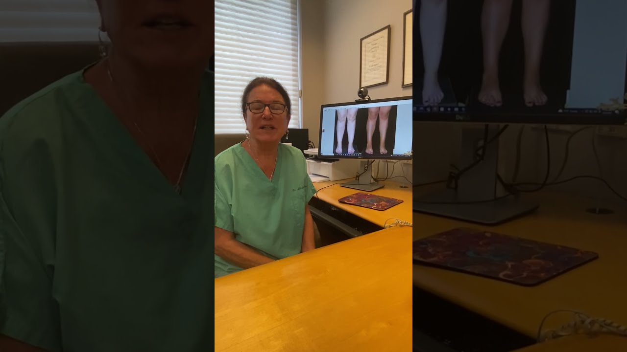 Improve Leg Contour with Calf and Ankle Liposuction