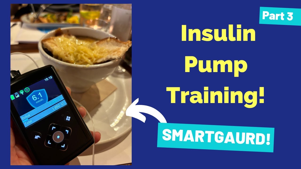 Insulin Pump Training Part 3- SMARTGAURD!