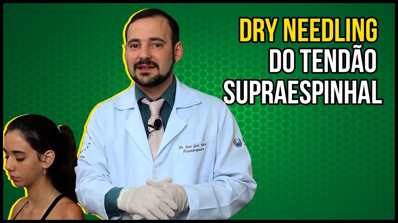 Dry Needling do Tendão Supraespinhal - VEJA EM TEMPO REAL