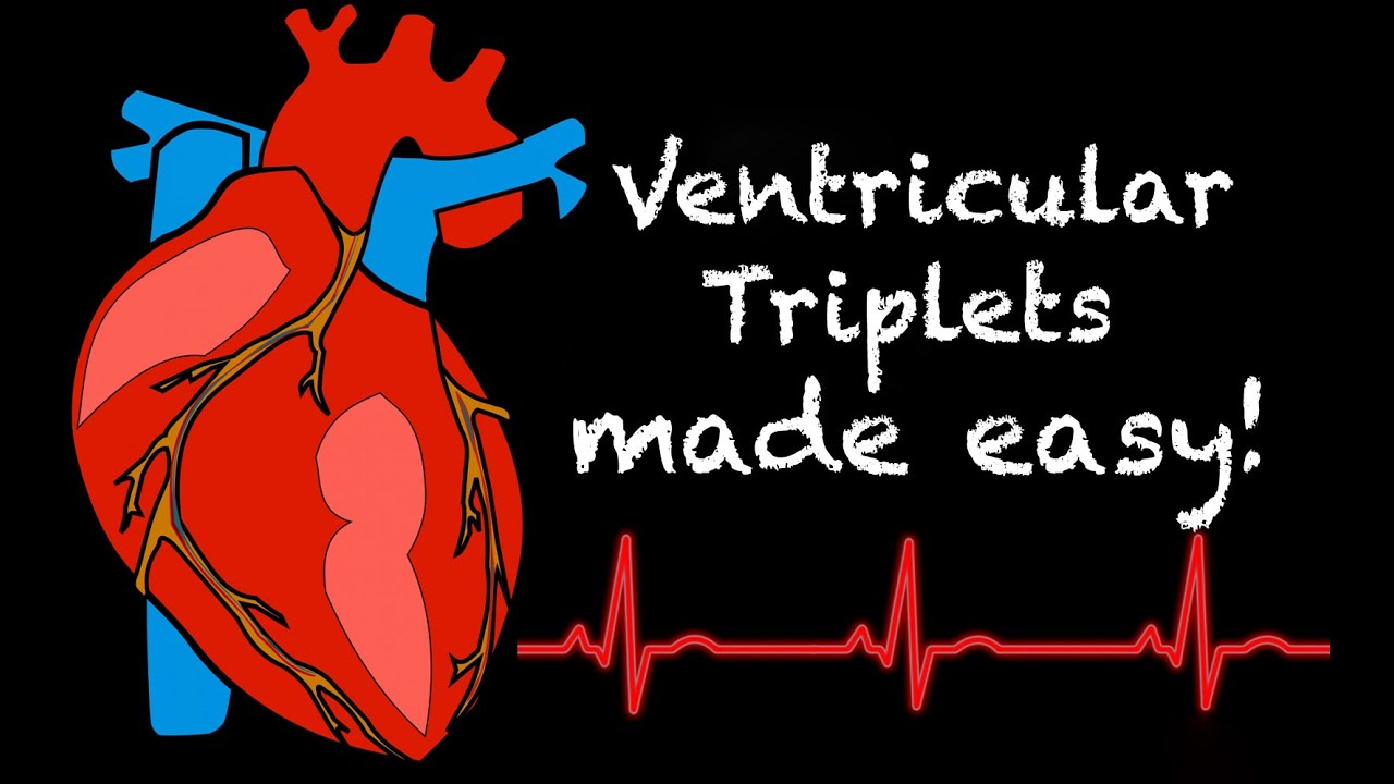 EMS Cardiology || Tachy Tuesday: Ventricular Triplets in EMS