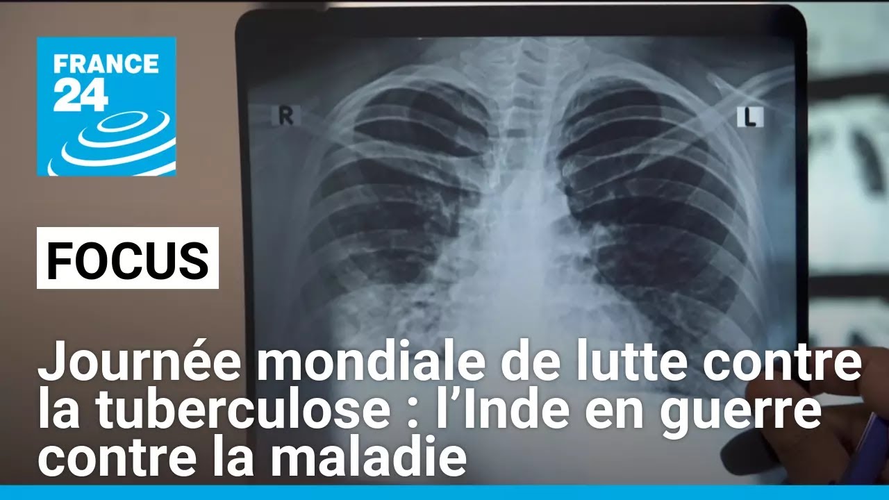 Journée mondiale de lutte contre la tuberculose : l’Inde en guerre contre la maladie