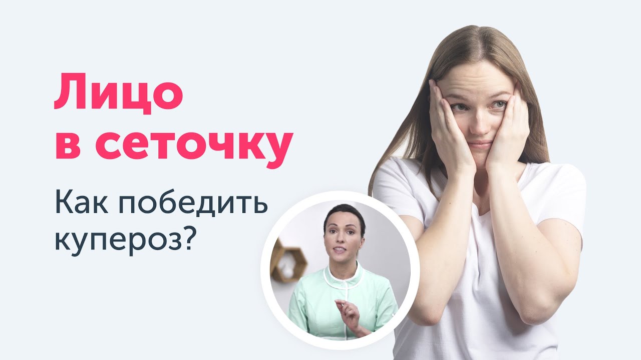 Как перестать краснеть? | Купероз и его причины