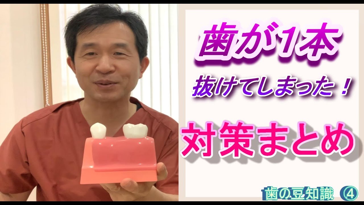 【歯が一本抜けた‼︎】どうする⁉︎２０年後、困らないようにする“対策まとめ”【歯医者が教える】