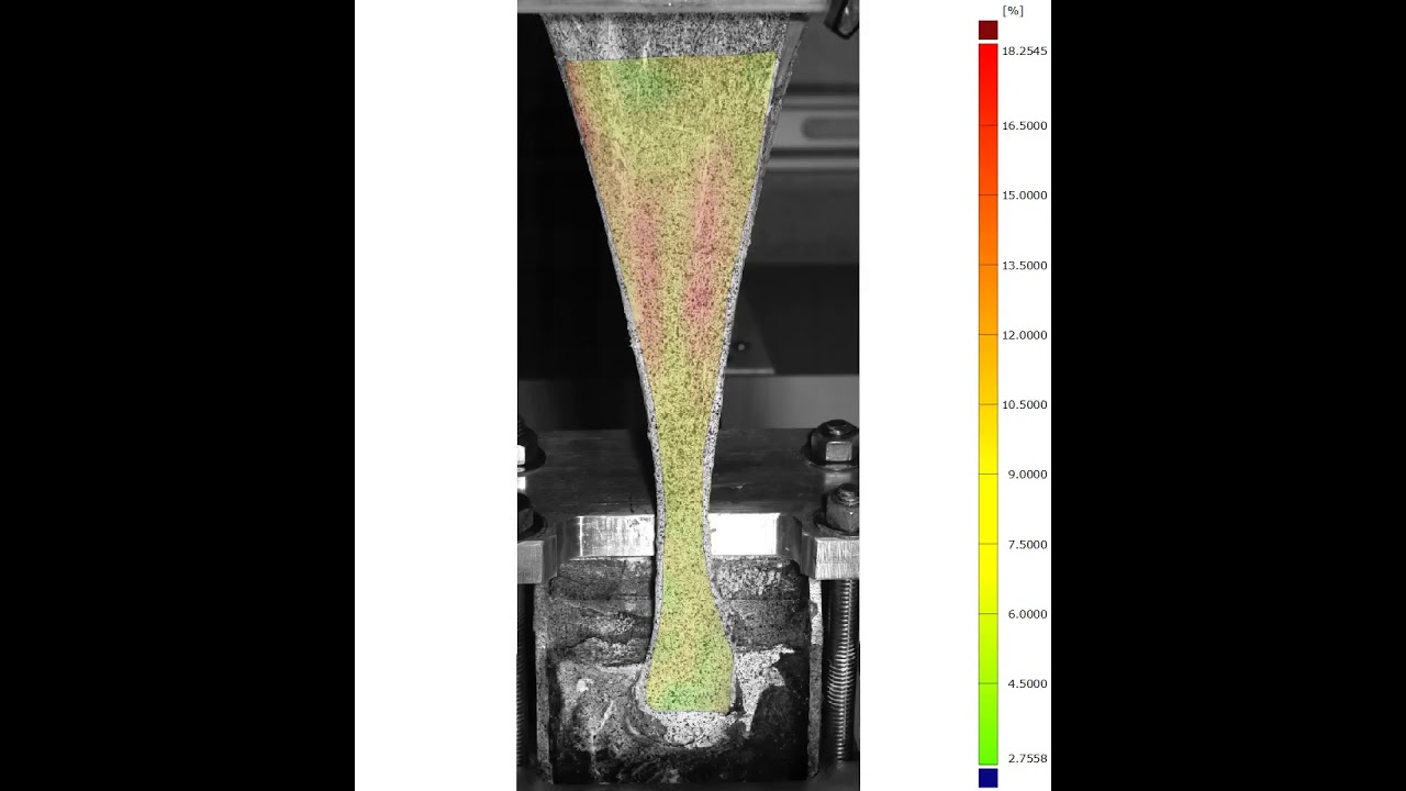 ACHILLES TENDON RUPTURE ... Here&rsquo;s the Human Biomechanics of it all! youtube.com/c/TimHewettPhD