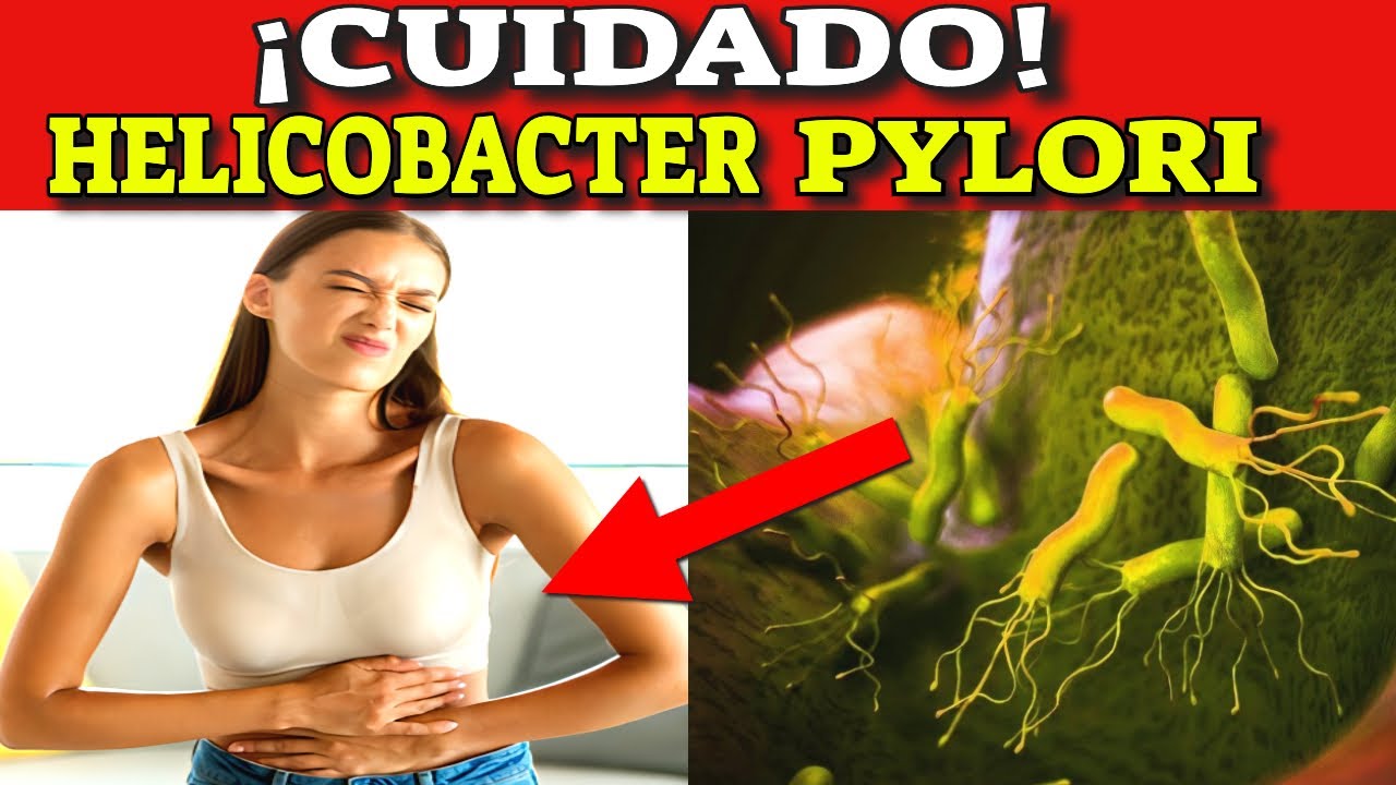 Cómo ELIMINAR la BACTERIA que CAUSA ÚLCERAS y GASTRITIS (Helicobacter Pylori)