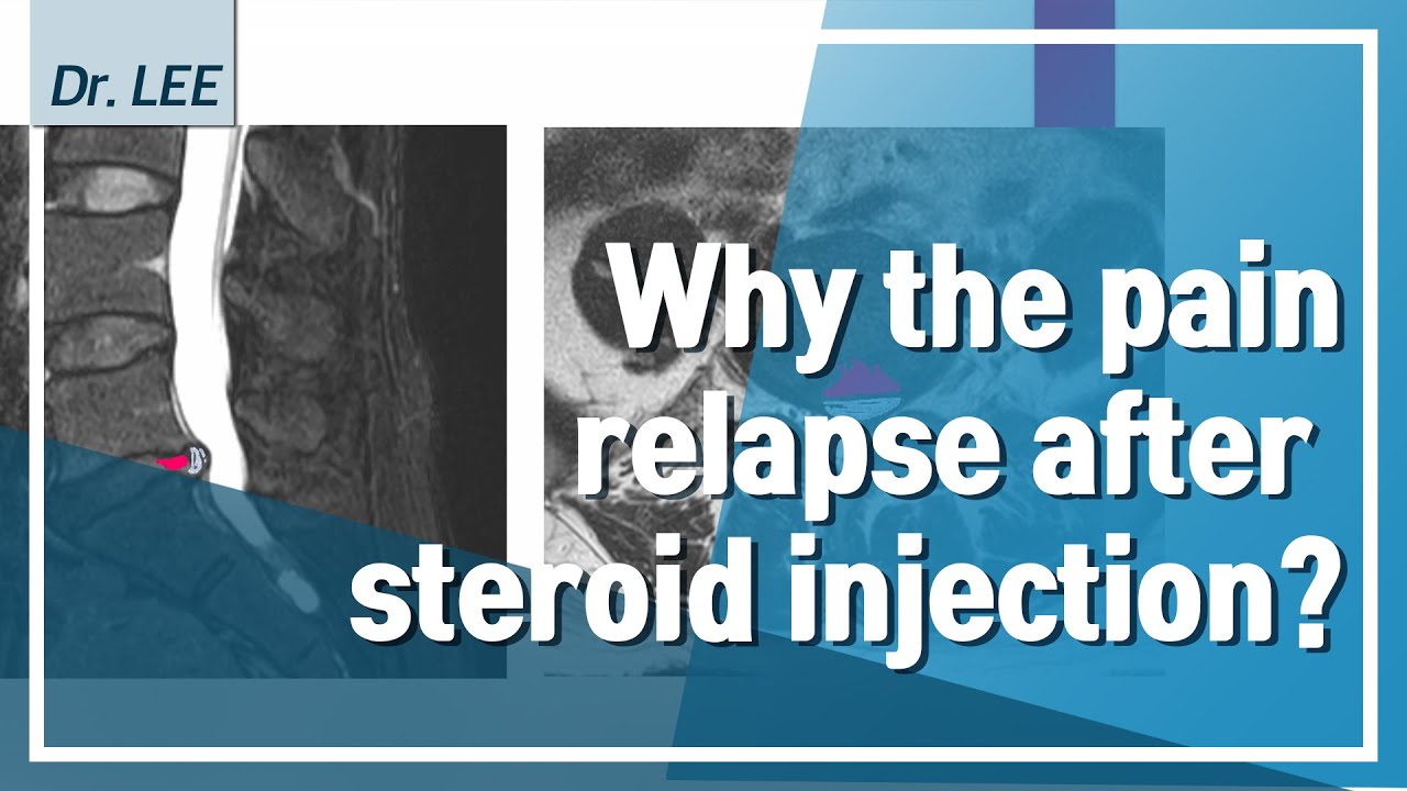 Trailer_Why the spinal pain relapse after operation or steroid injection