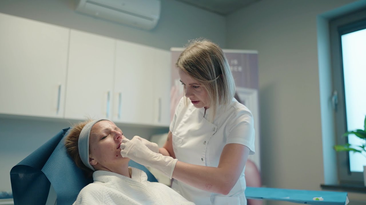 Kwas hialuronowy na zmarszczki mimiczne bez wypełniania