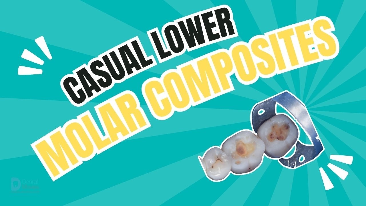 Casual lower molar composites