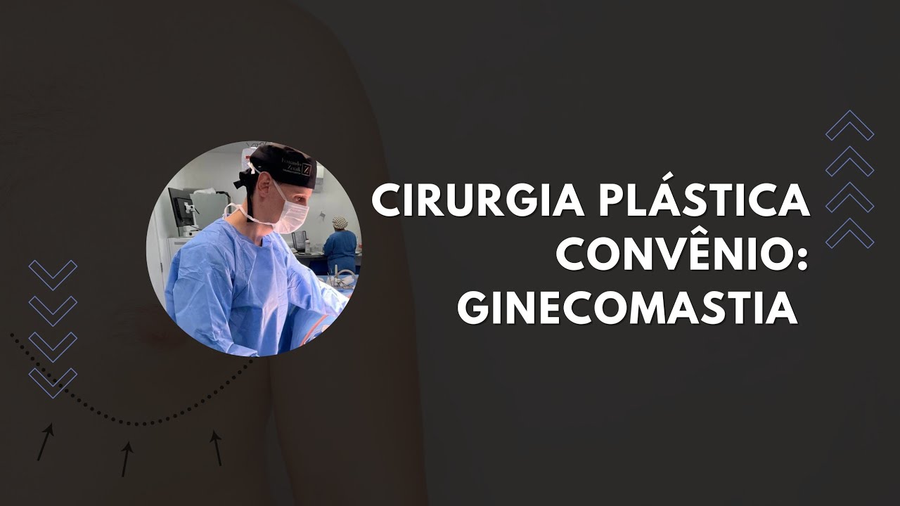 CIRURGIA PLÁSTICA PELO CONVÊNIO: GINECOMASTIA