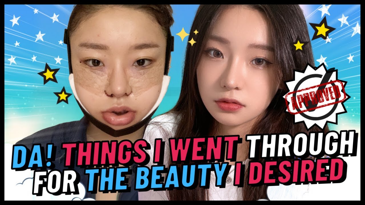 [Plastic Surgery in Korea] DA! Things I Went Through For The Beauty I Desired! Rhinoplasty in Korea