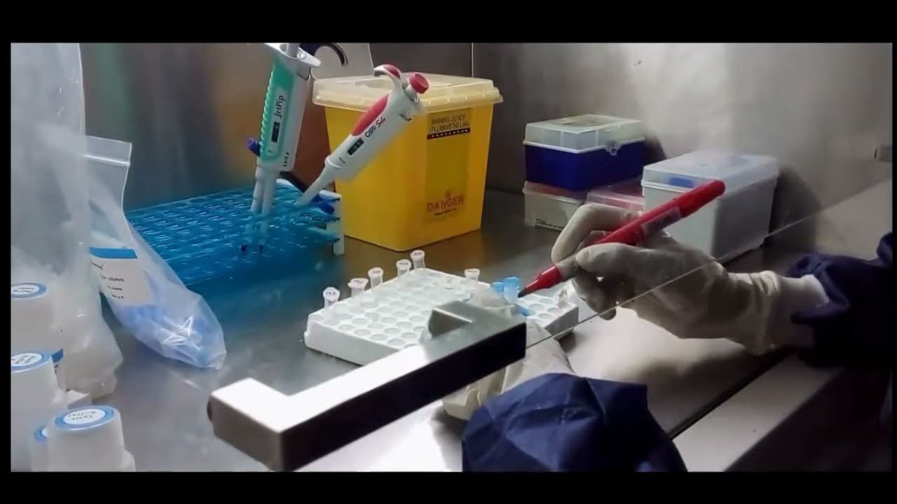 COVID 19 RNA Extraction methodology