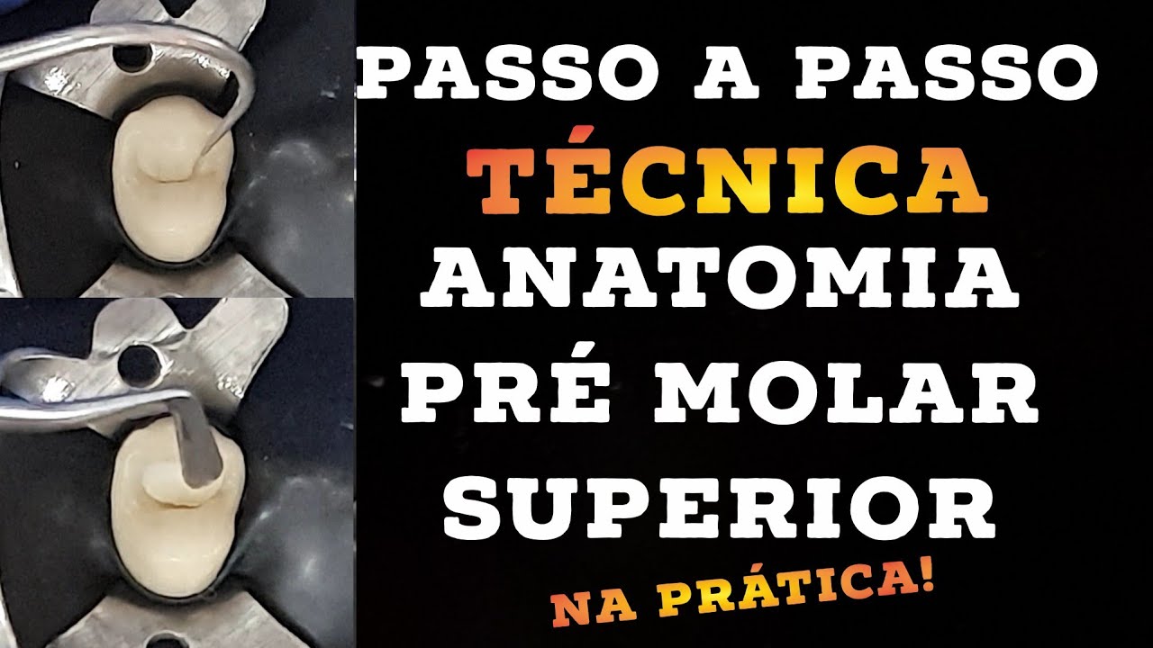 🛑PASSO A PASSO ANATOMIA 1 PRÉ MOLAR SUPERIOR! TÉCNICA 1 RISCO 2 RAIOS! INCRÍVEL🤫🎯