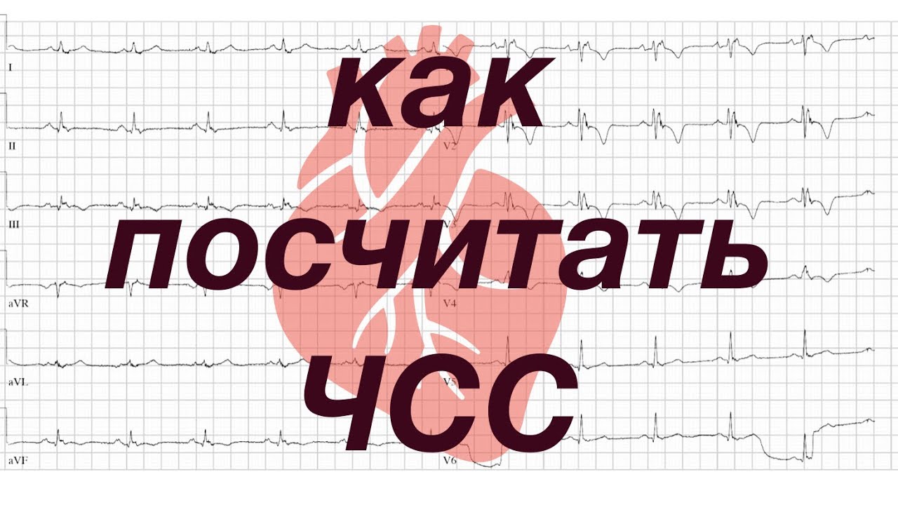 Как посчитать частоту сердечных сокращений по ЭКГ