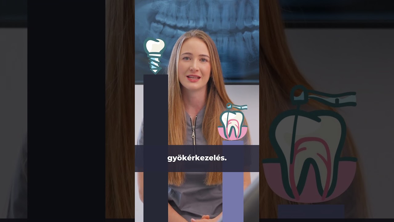 &Eacute;rdemes gy&ouml;k&eacute;rkezeltetni? | Artdent Fog&aacute;szat