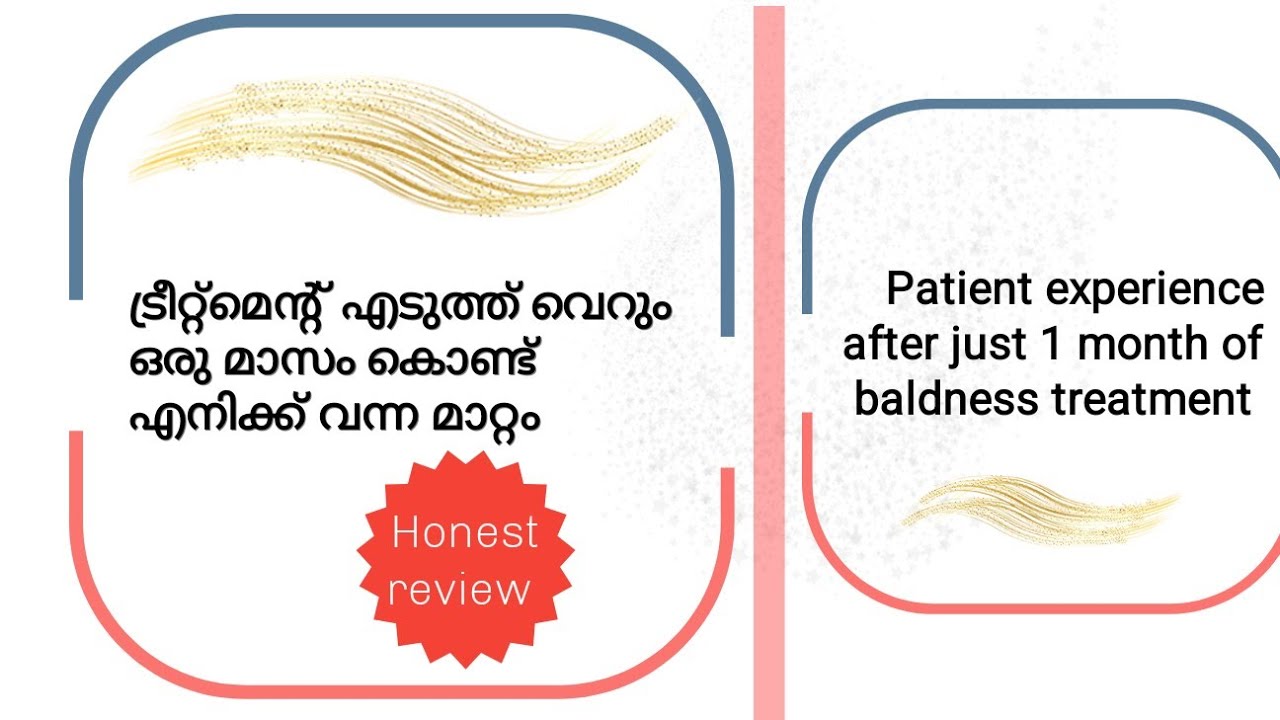 ഒരു മാസത്തിൽ എനിക്ക് മുടിവന്നതെങ്ങനെ? #dlapp #haircare #hairgrowth #stemcelltreatment #hairtips 