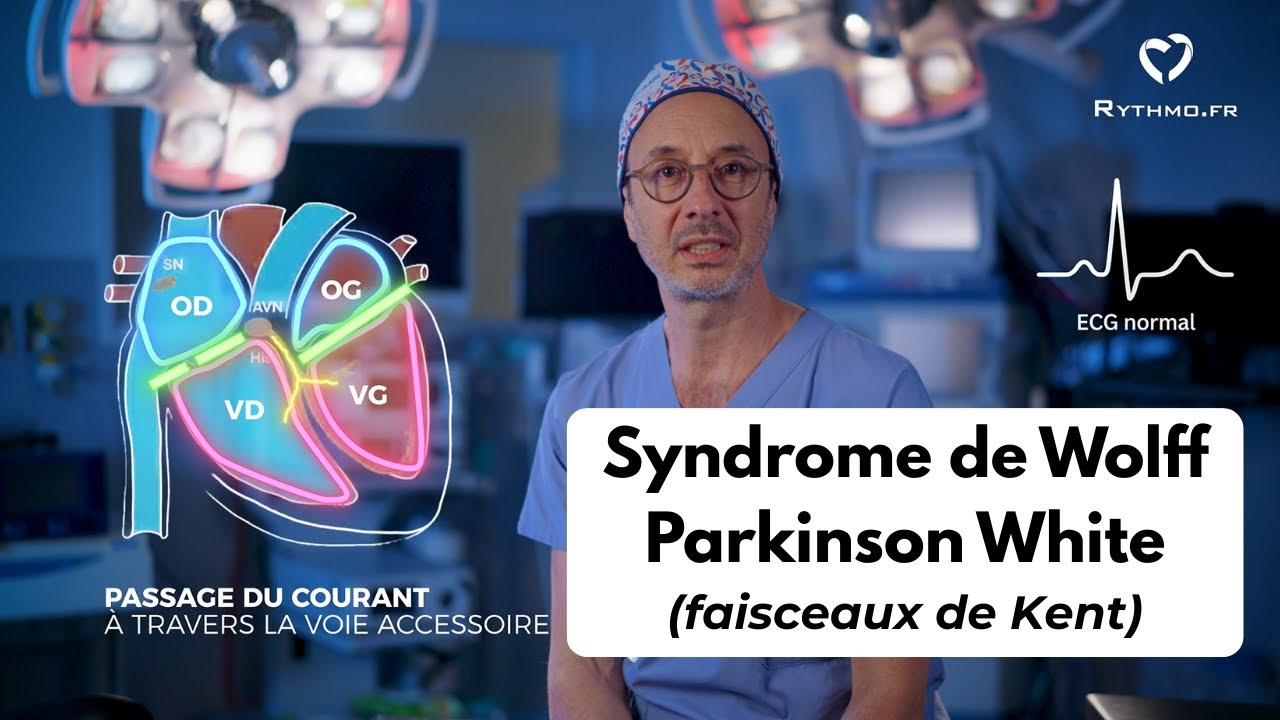 💓 Syndrome de Wolff Parkinson White (faisceau de Kent) : comprendre, diagnostiquer et traiter.