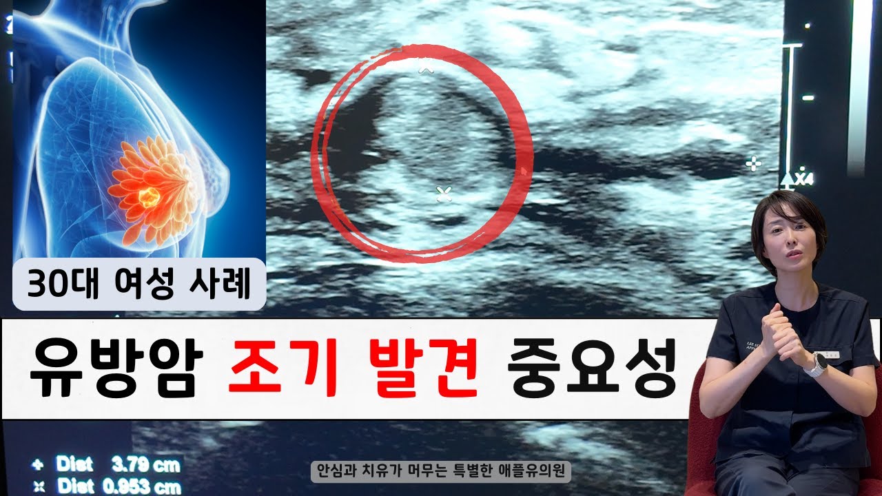 20,30대 젊은 여성 유방암 조기발견 중요성