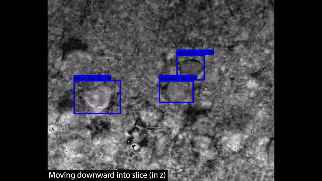 Real-time Neuron Detection in Brain Slice