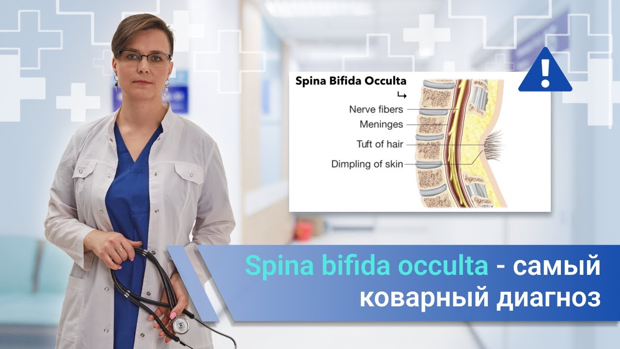 Spina bifida occulta - самая коварная патология/
