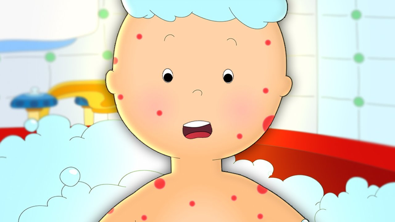 カイユー | カイユーと湿疹 | 面白い漫画 | キッズ漫画 | ケイルー | Caillou