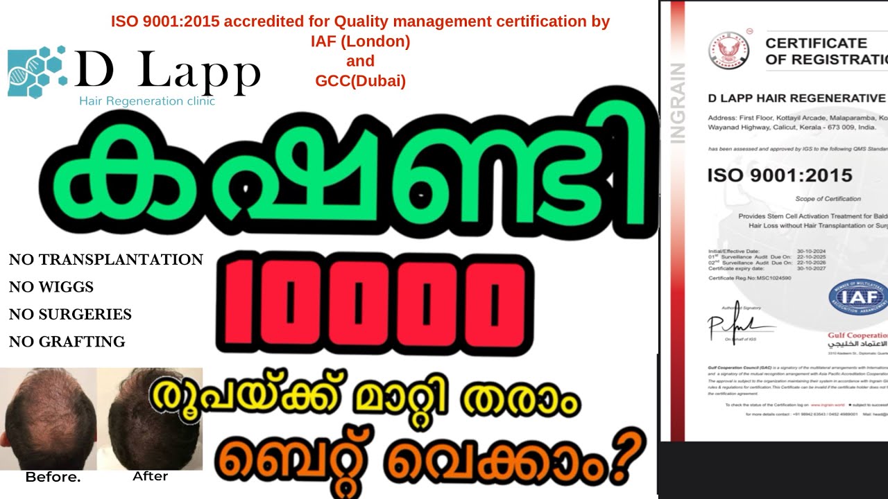 Have Rs10000?u bald?Don't worry finally the best hair growth formula out #dlapp #hairgrowth #viral