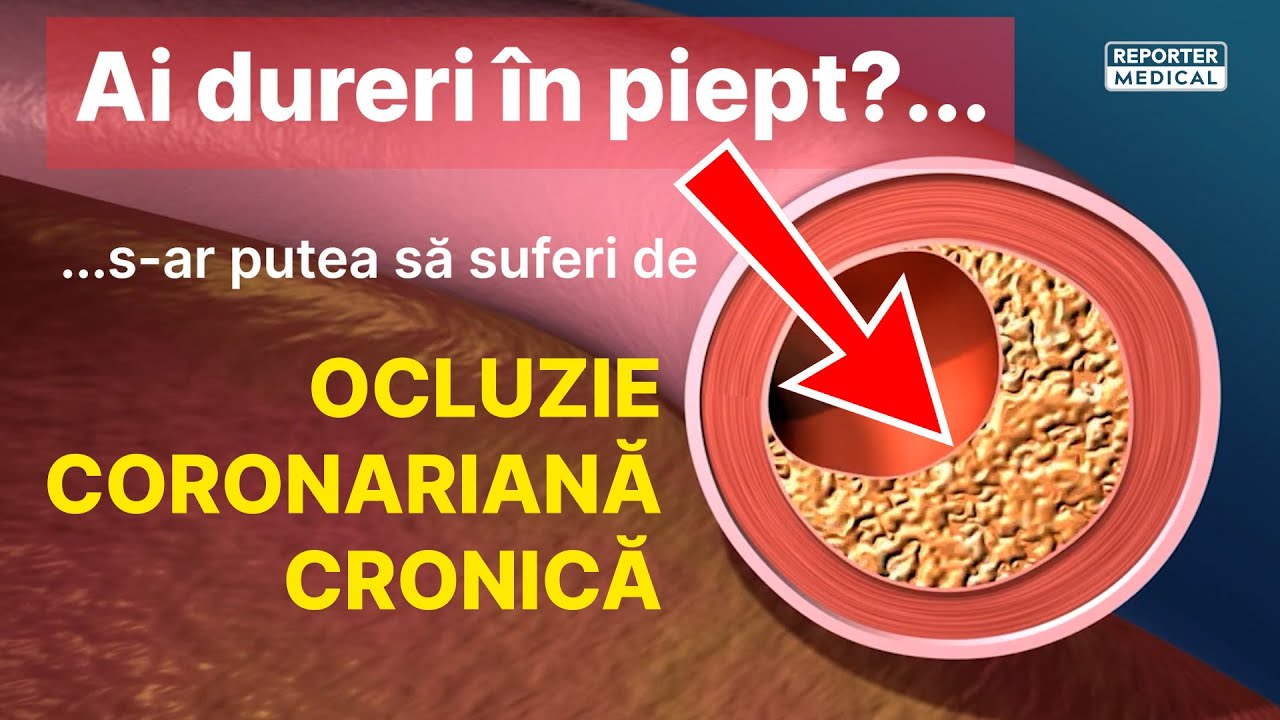 Ai dureri în piept? Cauza ar putea fi OCLUZIA CORONARIANĂ CRONICĂ!