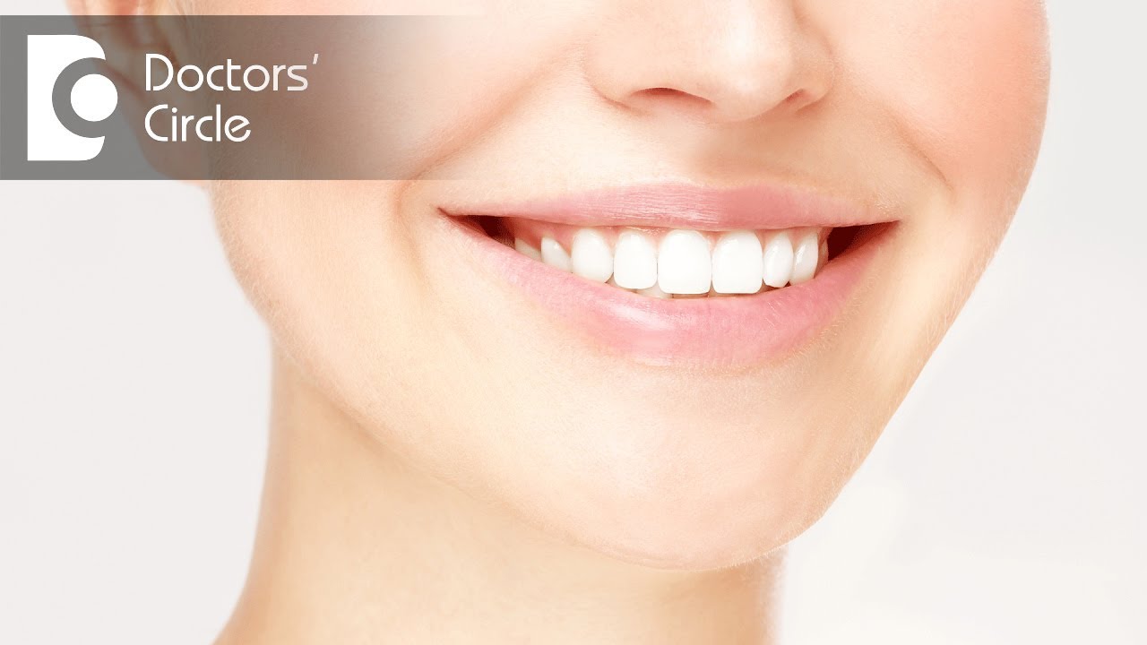 What is crowding of teeth? - Dr. Sai Kishore Reddy