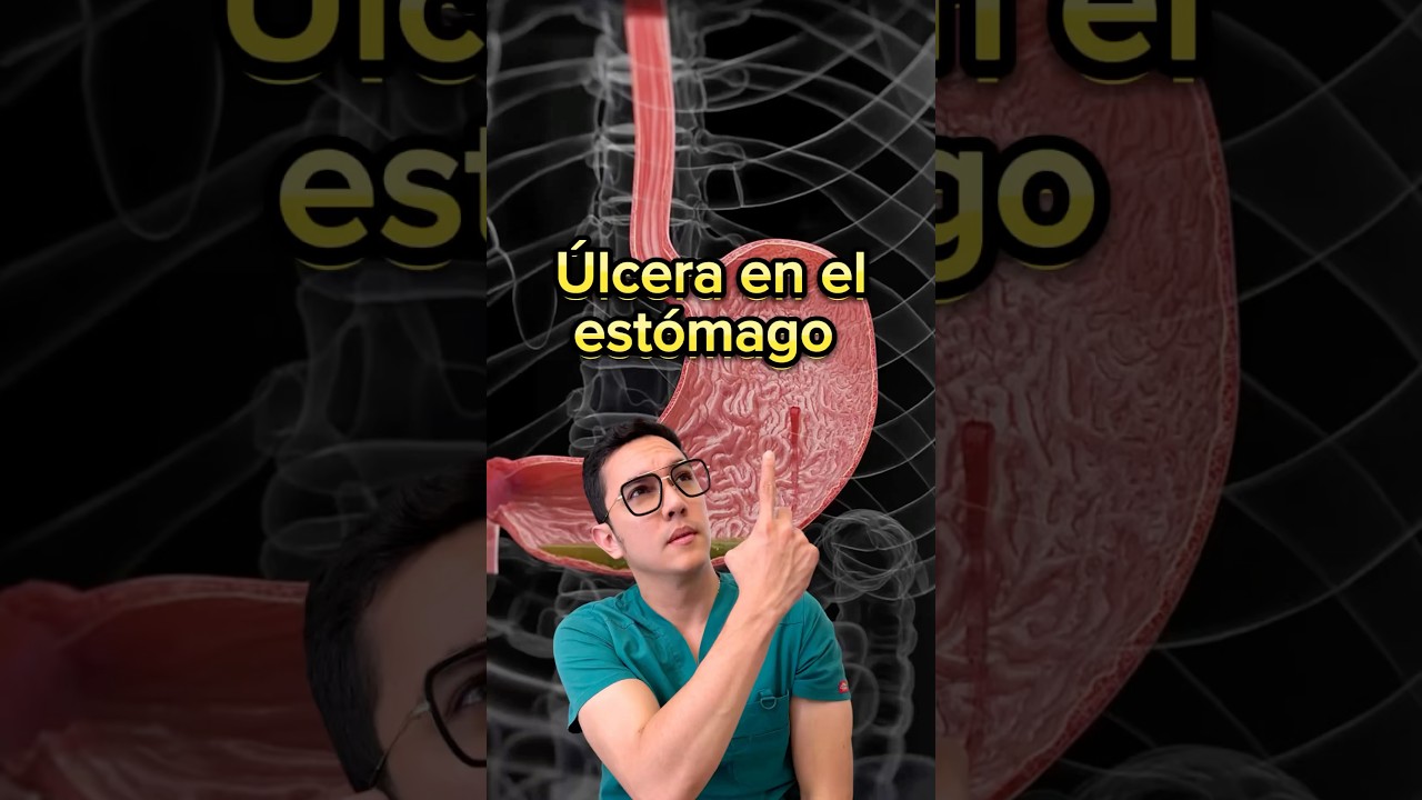 Úlcera en el estómago, principales causas. 