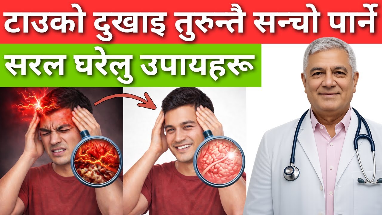 बिना औषधि टाउको दुखाइलाई चटक्कै बिसो बनाउने उपाय | Headache and Migraine Solution in Nepali