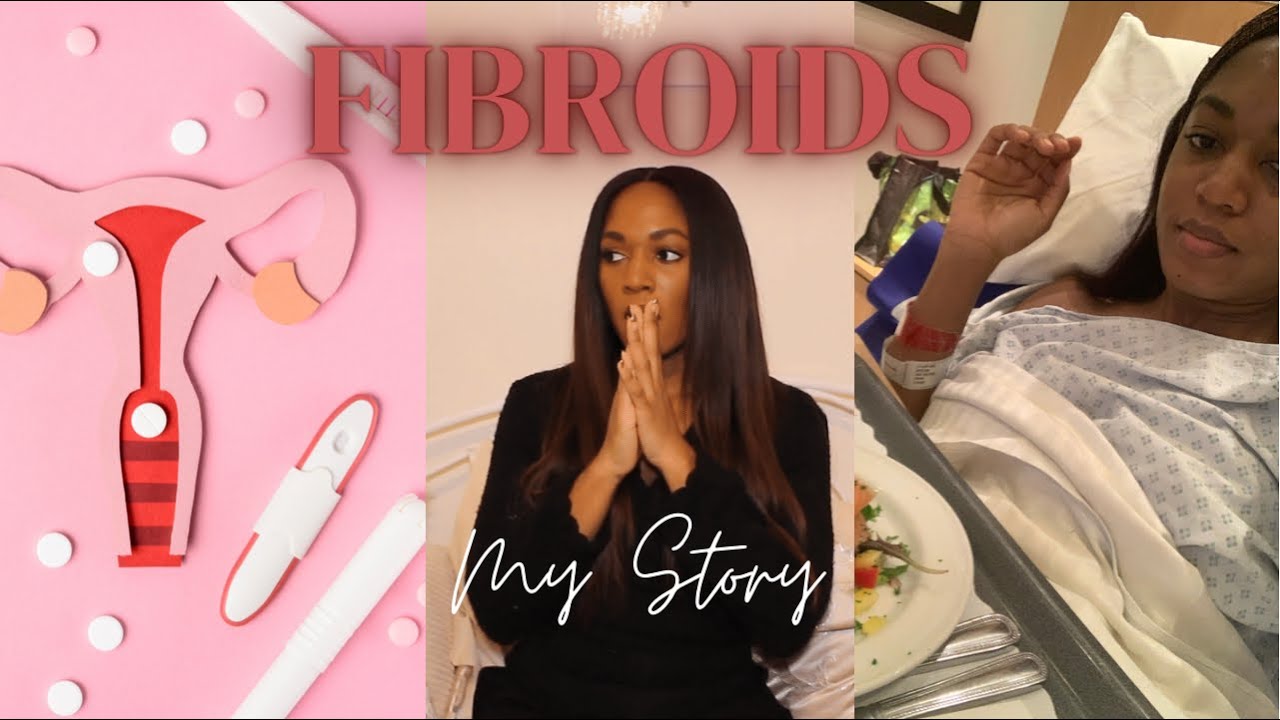 FIBROIDS: MY STORY |  PT.1 SYMPTOMS, DIAGNOSIS & PRE-OP OPEN MYOMECTOMY