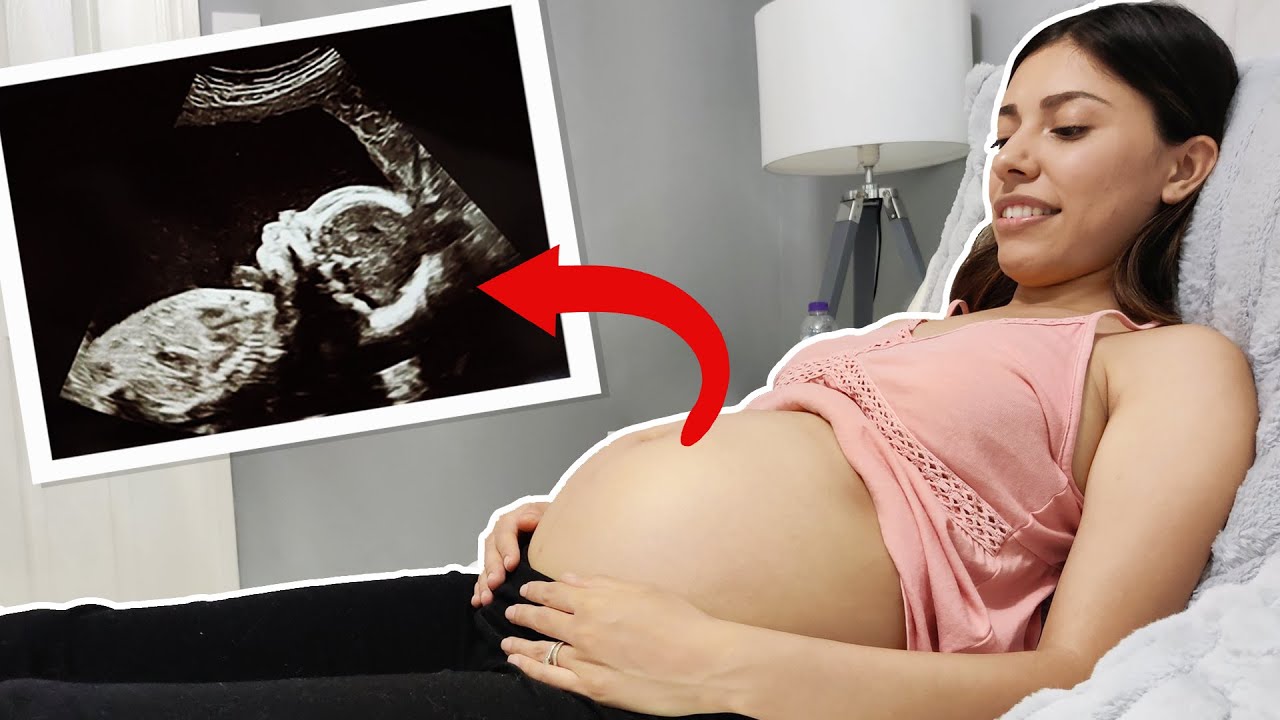 Seeing Our Baby For The First Time! *Baby Ultrasound*