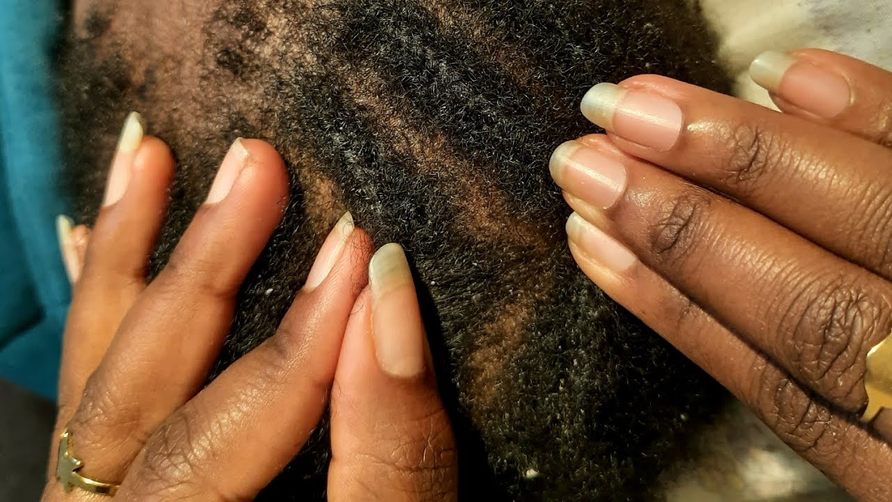 ASMR Tingly Hair Scalp Scratching with Blowing Sounds