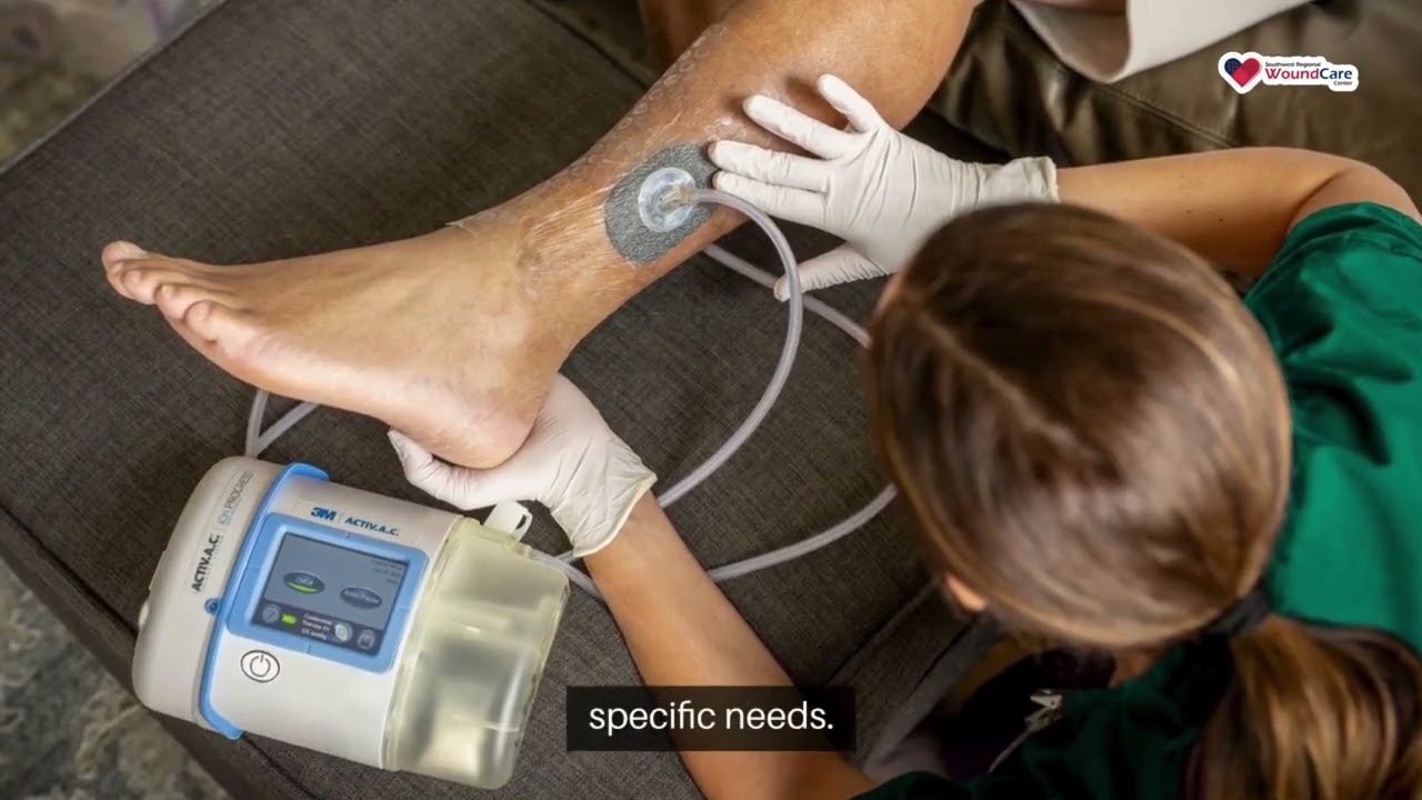 Why Are My Veins Visible? Veins Treatment in Lubbock, TX