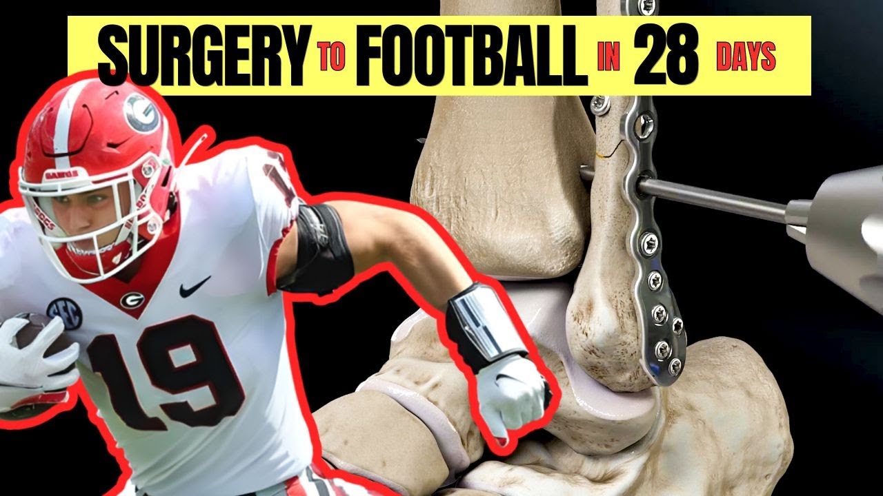 Fastest Fix for High Ankle Sprain in Athletes