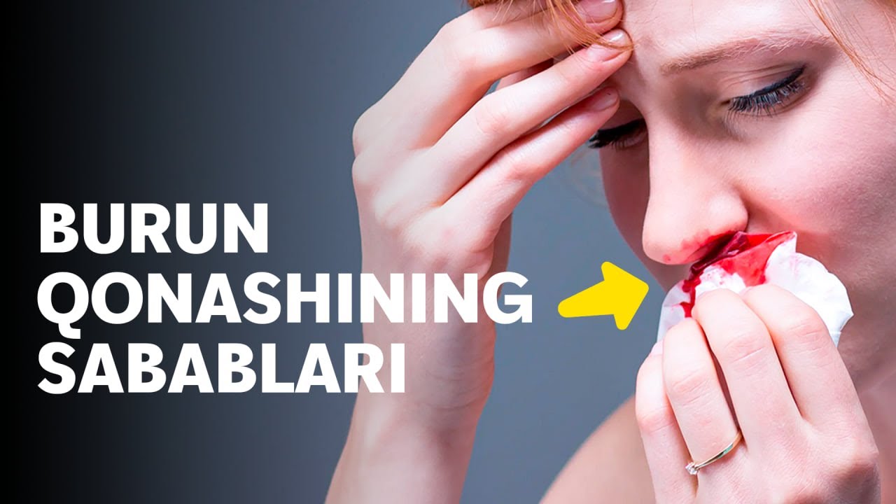 Burun Qonashi Sabablari - dr.Azizbek
