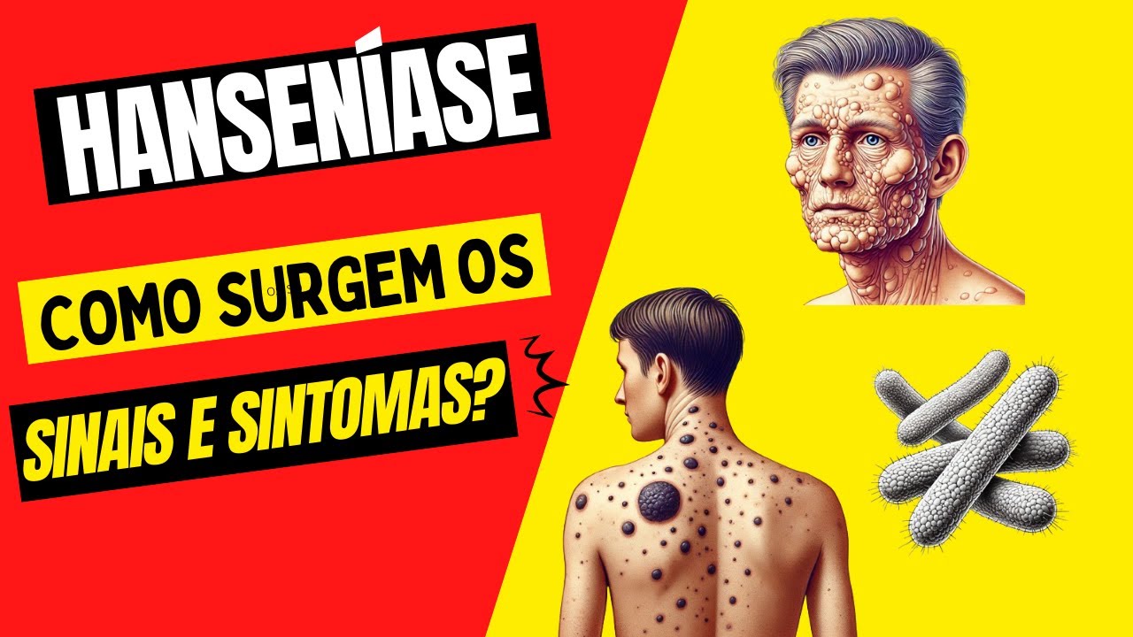 Sinais e Sintomas da Hanseníase - Quais são? Como surgem?