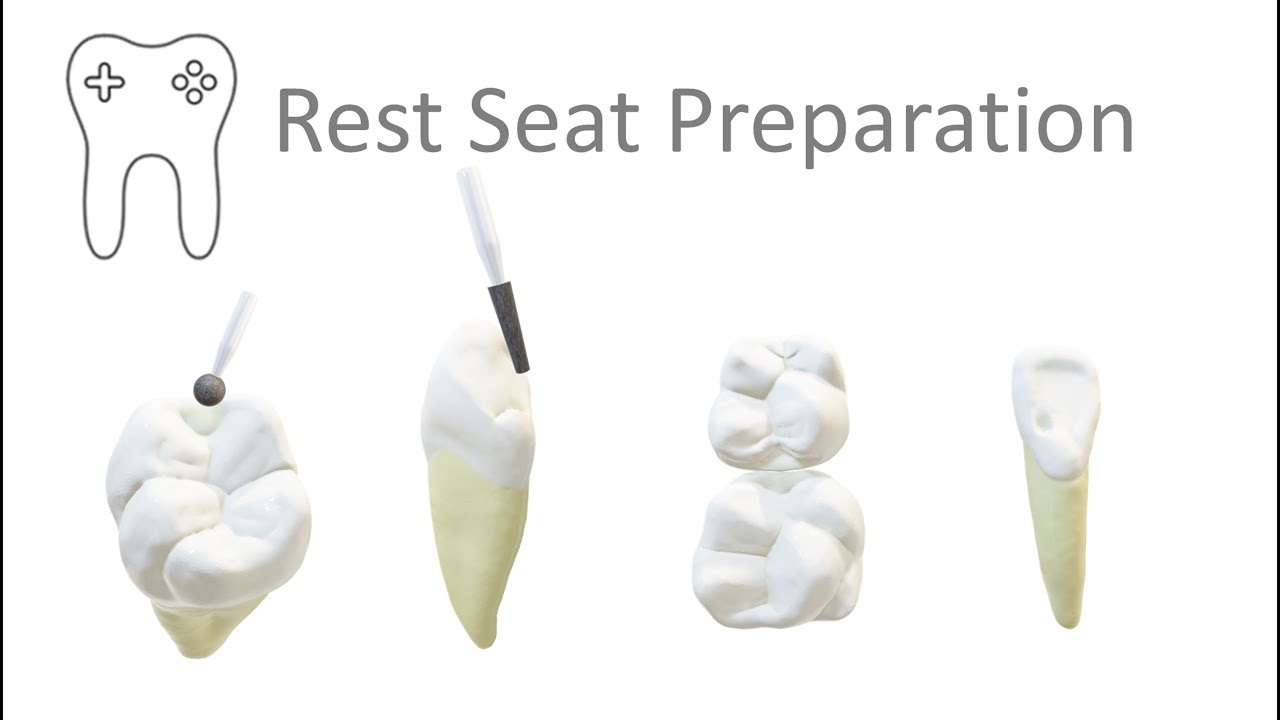 RPD Rest Seat Preparation technique in 6 mins