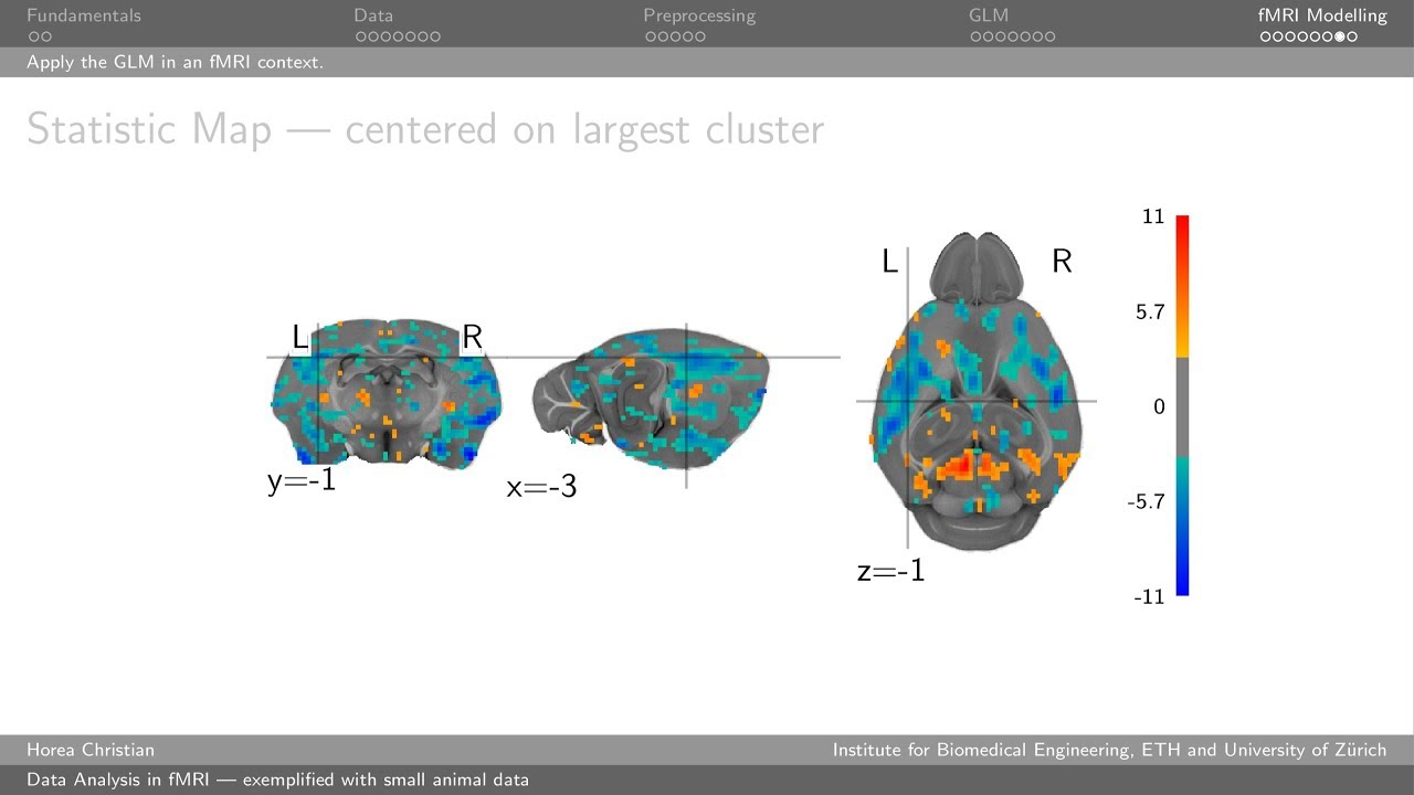 Data Analysis in fMRI | Experimental Neuroimaging Course 2018 | Zurich (CH)