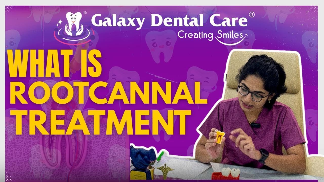 Root Canal Treatment  | Best Dental Hospital Clinic In Hyderabad