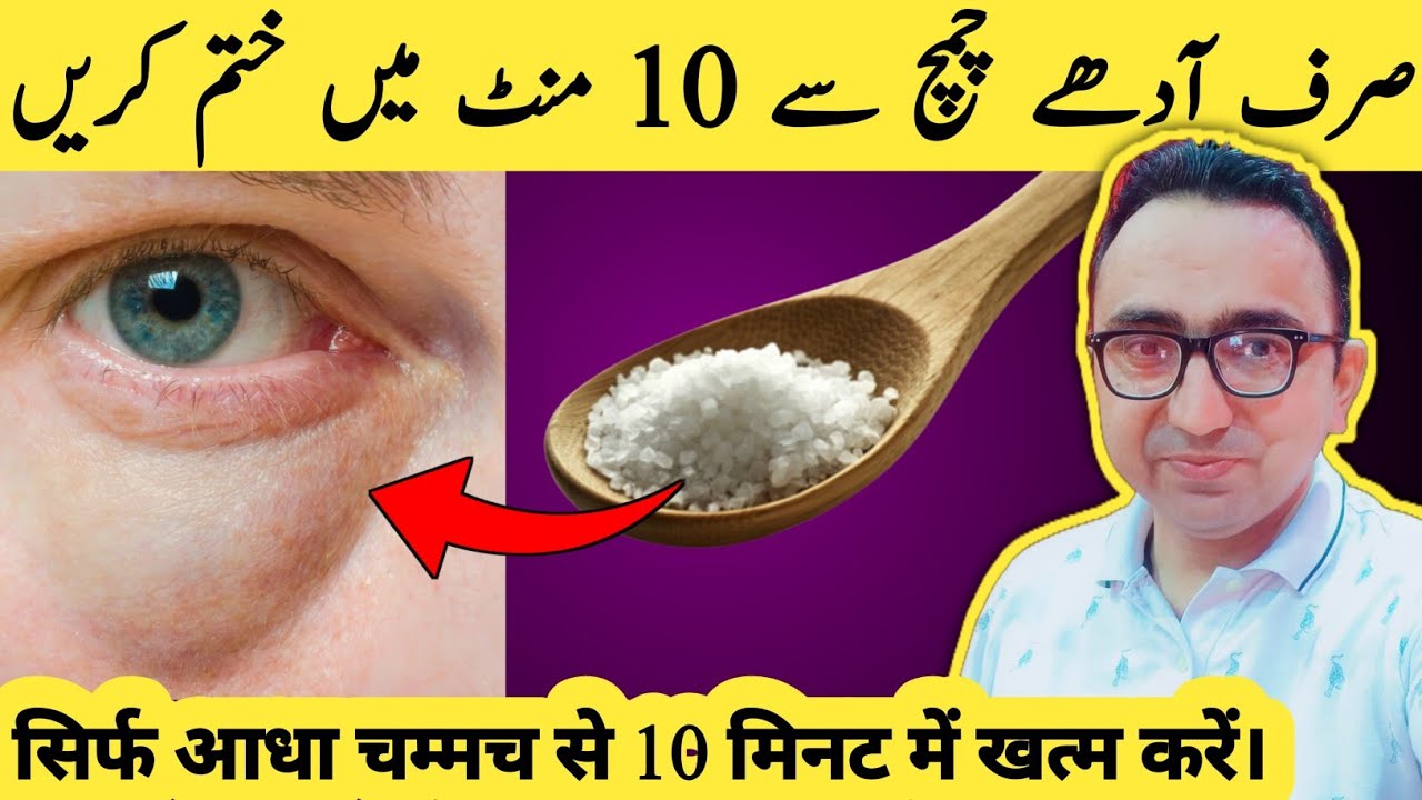 Puffy Eyes: Half Tsp of This Kitchen Ingredient Fixes It Fast!